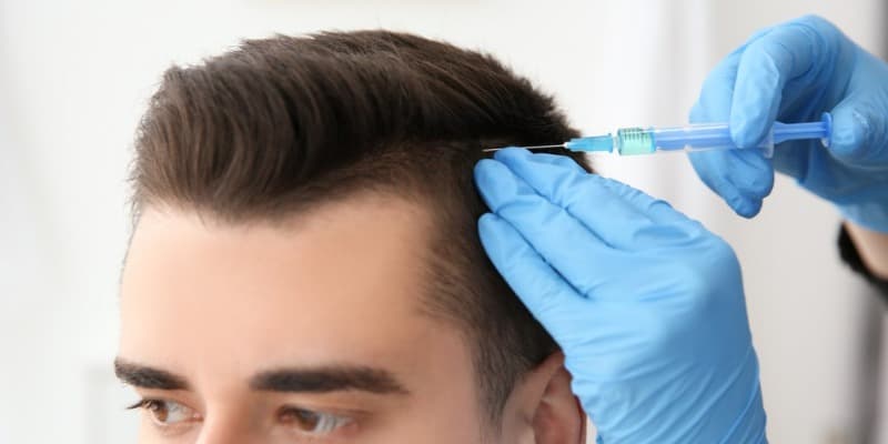 Hair Transplant Turkey – Natural Results, Exceptional Service